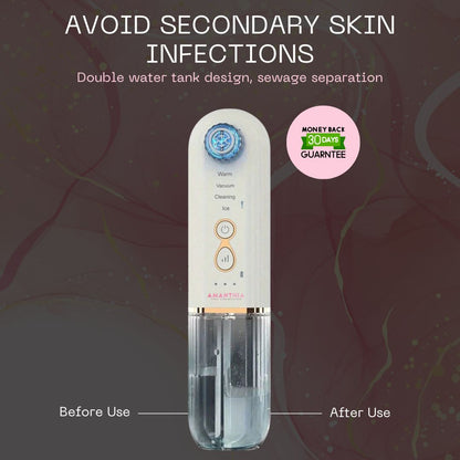 HydraCare Pro: Deep Pore & Hydration System